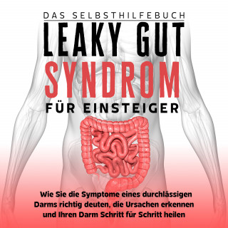 Christoph Beckonert: Leaky Gut Syndrom für Einsteiger - Das Selbsthilfebuch: Wie Sie die Symptome eines durchlässigen Darms richtig deuten, die Ursachen erkennen und Ihren Darm Schritt für Schritt heilen