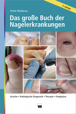 Anke Niederau: Das große Buch der Nagelerkrankungen