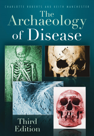 Charlotte Roberts, Keith Manchester: The Archaeology of Disease
