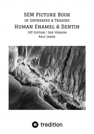 Ralf Janda: SEM Picture Book of Untreated & Treated Human Enamel & Dentin