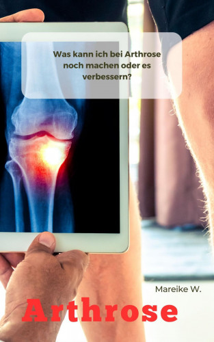 Mareike W.: Arthrose