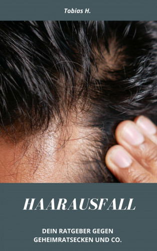 Tobias Hopfmüller: Haarausfall - dein Ratgeber gegen Geheimratsecken und Co.
