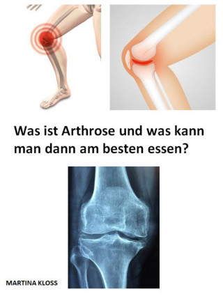 Martina Kloss: Was ist Arthrose und was kann man dann am besten essen?