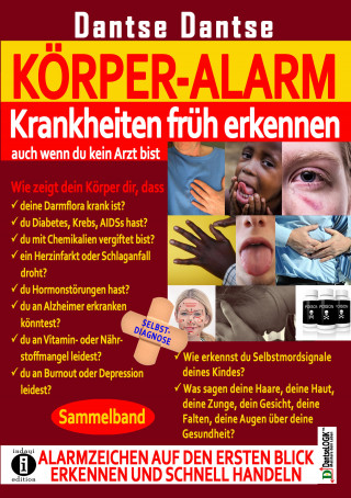 Guy Dantse: Körper-Alarm: Krankheiten früh erkennen, auch wenn du kein Arzt bist! - Sammelband