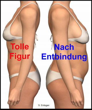 S. Erdogan: Tolle Figur – Nach Entbindung