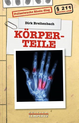 Dirk Breitenbach: Körperteile