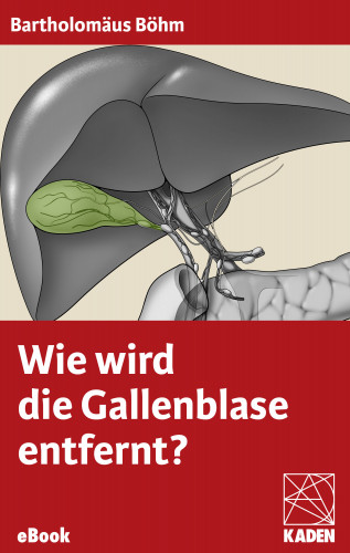 Bartholomäus Böhm: Wie wird die Gallenblase entfernt?