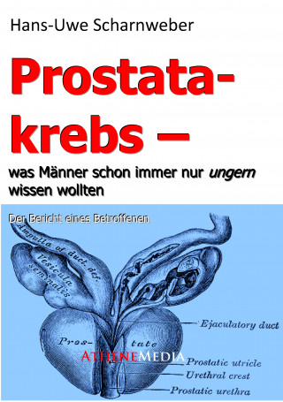 Hans-Uwe Scharnweber: Prostatakrebs