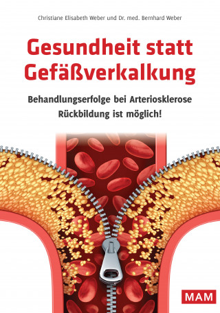 Dr. med. Bernhard Weber, Christiane Elisabeth Weber: Gesundheit statt Gefäßverkalkung