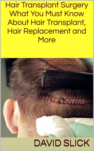 David Slick: Hair Transplant Surgery