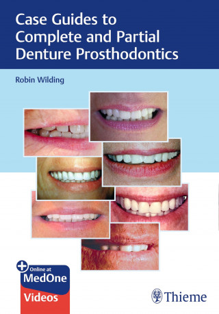 Robin Wilding: Case Guides to Complete and Partial Denture Prosthodontics