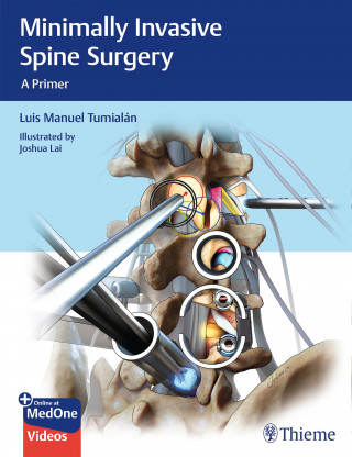 Luis Manuel Tumialan: Minimally Invasive Spine Surgery