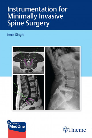 Kern Singh: Instrumentation for Minimally Invasive Spine Surgery