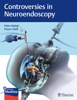 Peter Nakaji, Hasan A. Zaidi: Controversies in Neuroendoscopy