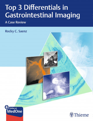 Rocky C. Saenz: Top 3 Differentials in Gastrointestinal Imaging