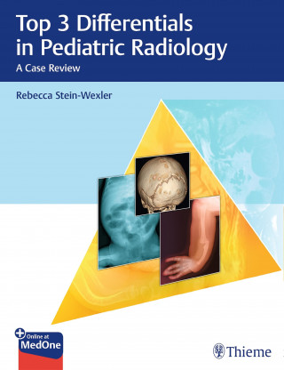 Rebecca Stein-Wexler: Top 3 Differentials in Pediatric Radiology