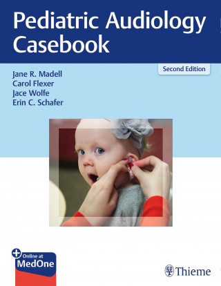 Jane R. Madell, Carol Flexer, Jace Wolfe, Erin C. Schafer: Pediatric Audiology Casebook