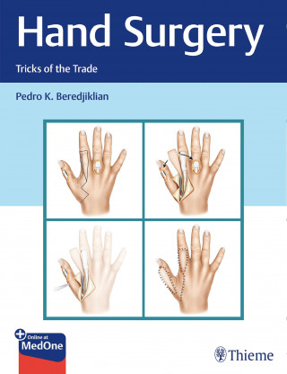 Pedro Beredjiklian: Hand Surgery