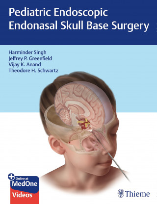 Harminder Singh, Jeffrey P. Greenfield, Vijay K. Anand, Theodore H. Schwartz: Pediatric Endoscopic Endonasal Skull Base Surgery