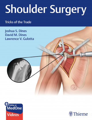 Joshua Dines, David M. Dines, Lawrence V. Gulotta: Shoulder Surgery