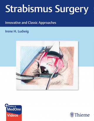 Irene Ludwig: Strabismus Surgery