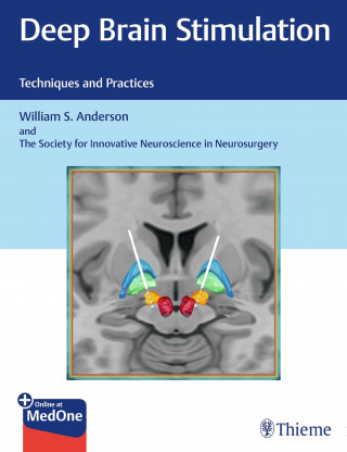 William S. Anderson, The Society for Innovative Neuroscience: Deep Brain Stimulation