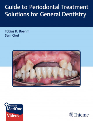 Tobias K. Boehm, Sam Chui: Guide to Periodontal Treatment Solutions for General Dentistry