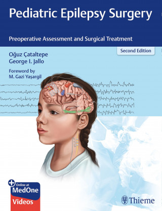 Oguz Cataltepe, George I. Jallo: Pediatric Epilepsy Surgery