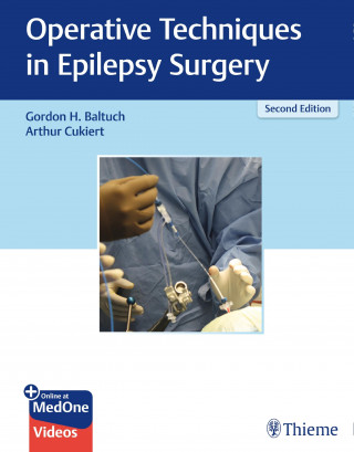 Gordon H. Baltuch, Arthur Cukiert: Operative Techniques in Epilepsy Surgery