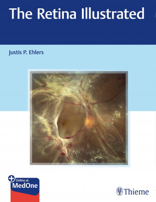 Justis P. Ehlers: The Retina Illustrated