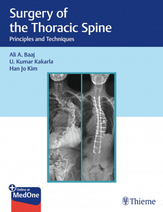 Ali A. Baaj, U. Kumar Kakarla, Han Jo Kim: Surgery of the Thoracic Spine
