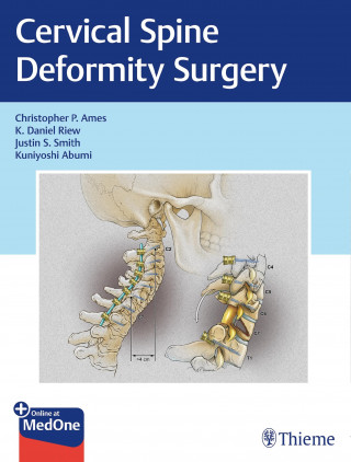 Christopher P. Ames, K. Daniel Riew, Justin S. Smith, Kuniyoshi Abumi: Cervical Spine Deformity Surgery