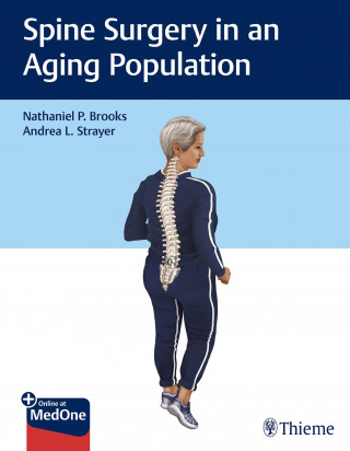 Nathaniel P. Brooks, Andrea L. Strayer: Spine Surgery in an Aging Population