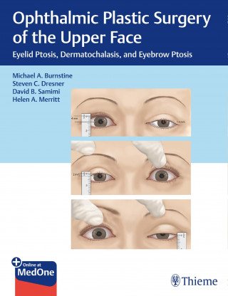 Michael A. Burnstine, Steven C. Dresner, David B. Samimi, Helen A. Merritt: Ophthalmic Plastic Surgery of the Upper Face