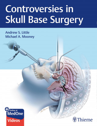 Andrew S. Little, Michael A. Mooney: Controversies in Skull Base Surgery