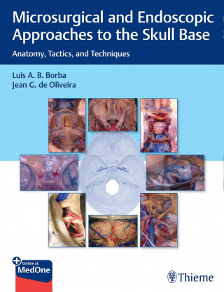 Luis Borba, Jean de Oliveira: Microsurgical and Endoscopic Approaches to the Skull Base