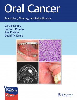 Carole Fakhry, Karen T. Pitman, Ana P. Kiess, David W. Eisele: Oral Cancer