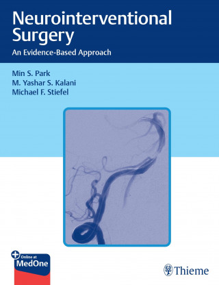 Min S. Park, M. Yashar Kalani, Michael Stiefel: Neurointerventional Surgery