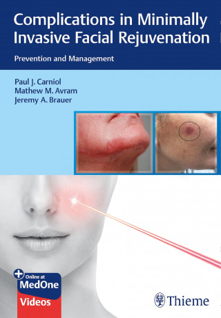 Paul J. Carniol, Mathew M. Avram, Jeremy A. Brauer: Complications in Minimally Invasive Facial Rejuvenation