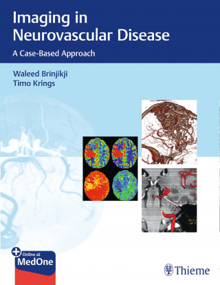Waleed Brinjikji, Timo Krings: Imaging in Neurovascular Disease