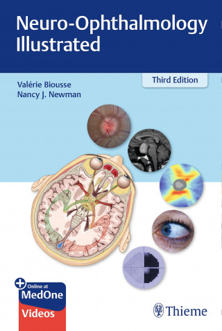 Valerie Biousse, Nancy Newman: Neuro-Ophthalmology Illustrated