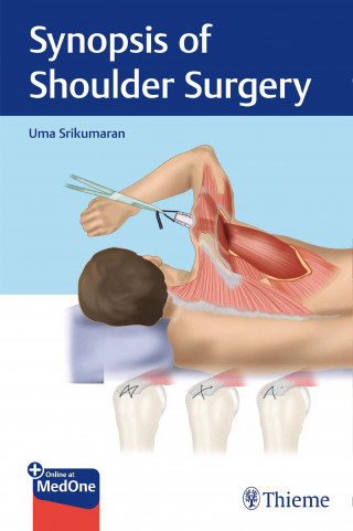 Uma Srikumaran: Synopsis of Shoulder Surgery