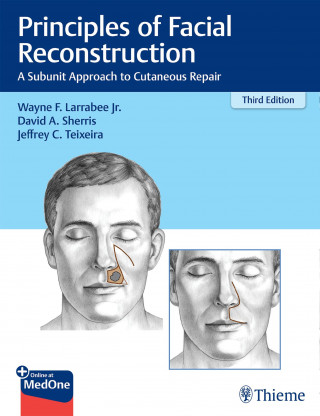 Wayne F. Larrabee, David A. Sherris, Jeffrey Teixeira: Principles of Facial Reconstruction