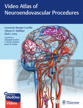 Leonardo Rangel-Castilla, Adnan H. Siddiqui, Elad I. Levy, Giuseppe Lanzino, Jason Davies, L. Nelson Hopkins: Video Atlas of Neuroendovascular Procedures