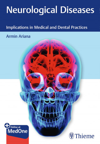Armin Ariana: Neurological Diseases