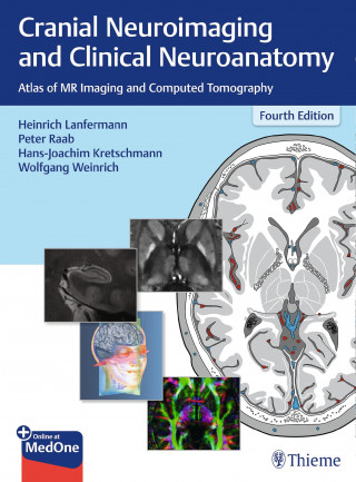 Hans-Joachim Kretschmann, Wolfgang Weinrich: Cranial Neuroimaging and Clinical Neuroanatomy