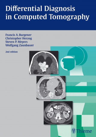 Francis A. Burgener, Christopher Herzog, Steven Meyers, Wolfgang Zaunbauer: Differential Diagnosis in Computed Tomography