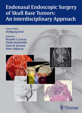 Wolfgang Draf, Ricardo L. Carrau, Ulrike Bockmühl, Amin B. Kassam, Peter Vajkoczy: Endonasal Endoscopic Surgery of Skull Base Tumors: An Interdisciplinary Approach