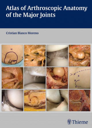 Cristian Blanco Moreno: Atlas of Arthroscopic Anatomy of the Major Joints