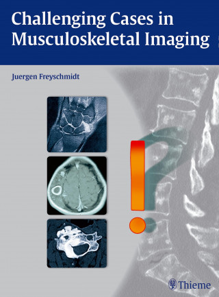 Jürgen Freyschmidt: Challenging Cases in Musculoskeletal Imaging